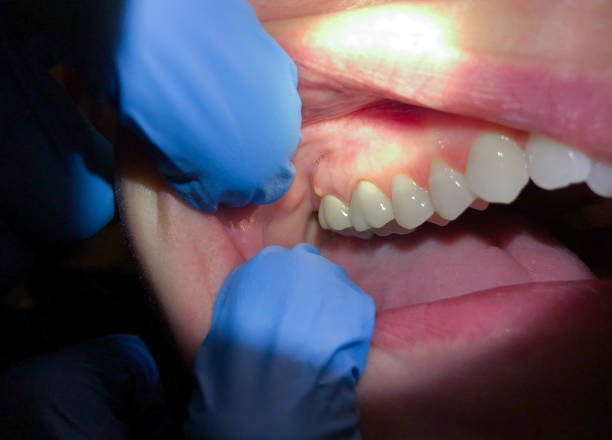 Best Emergency Broken Tooth Repair in Moreland Hills, OH