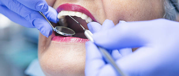 Best Emergency Treatment for Toothache in Moreland Hills, OH